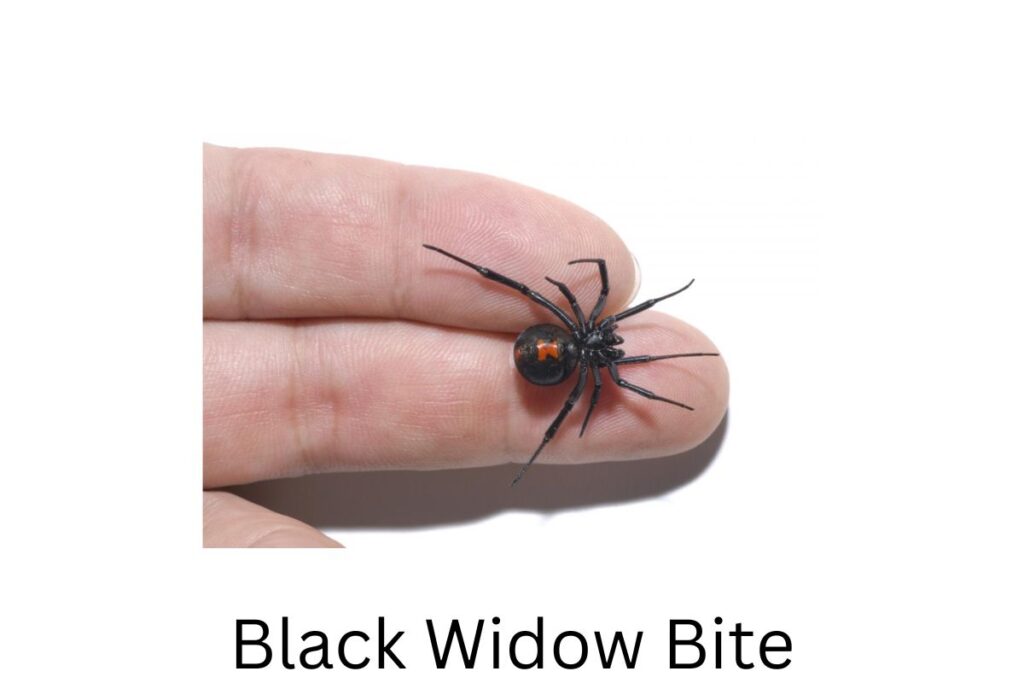 Black Widow Bite