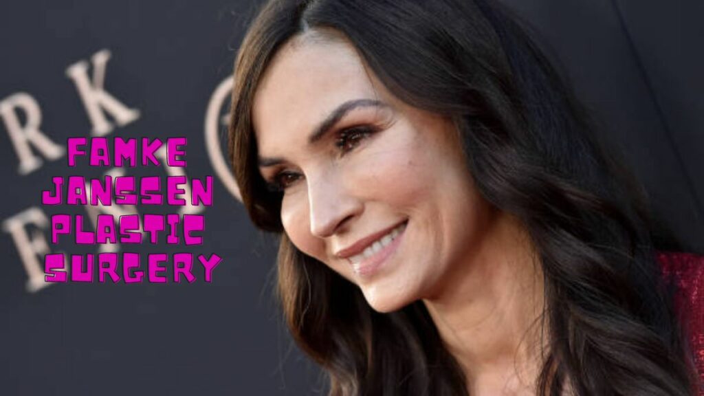 Famke Janssen Plastic Surgery