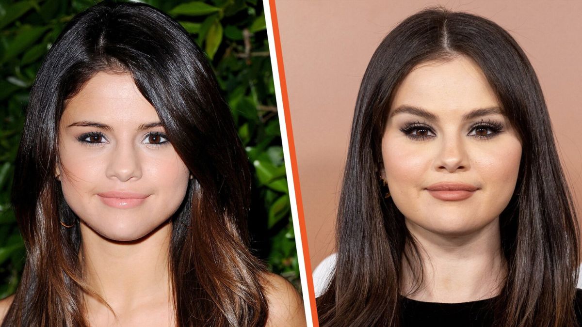 Did Selena Gomez Have Plastic Surgery