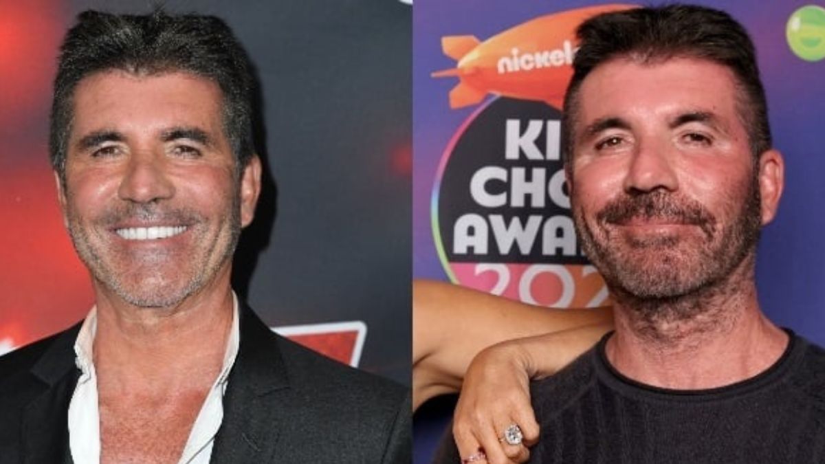 Simon Cowell Opens Up About Plastic Surgery