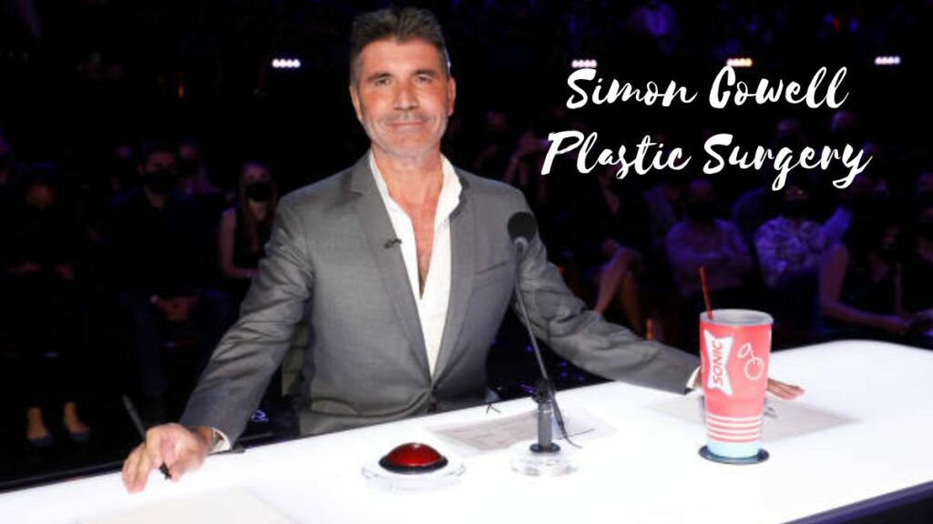 Simon Cowell Plastic Surgery