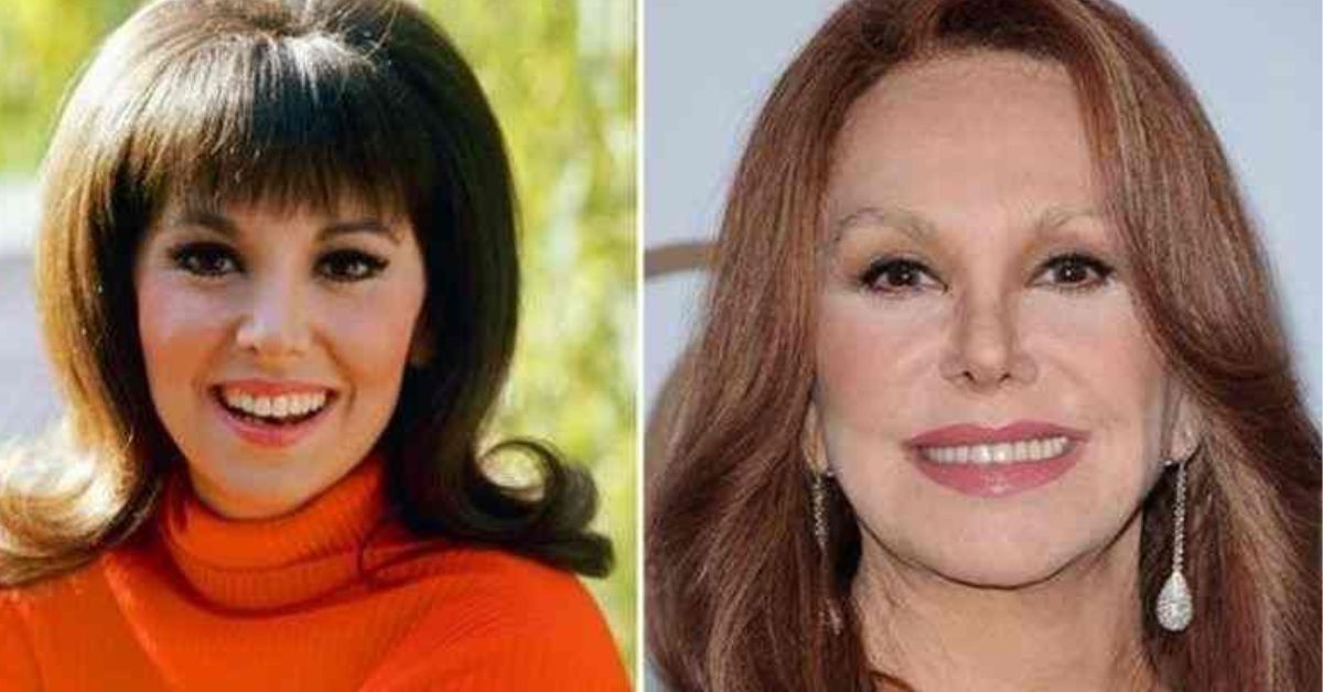 Did Marlo Thomas Get A Nose Job