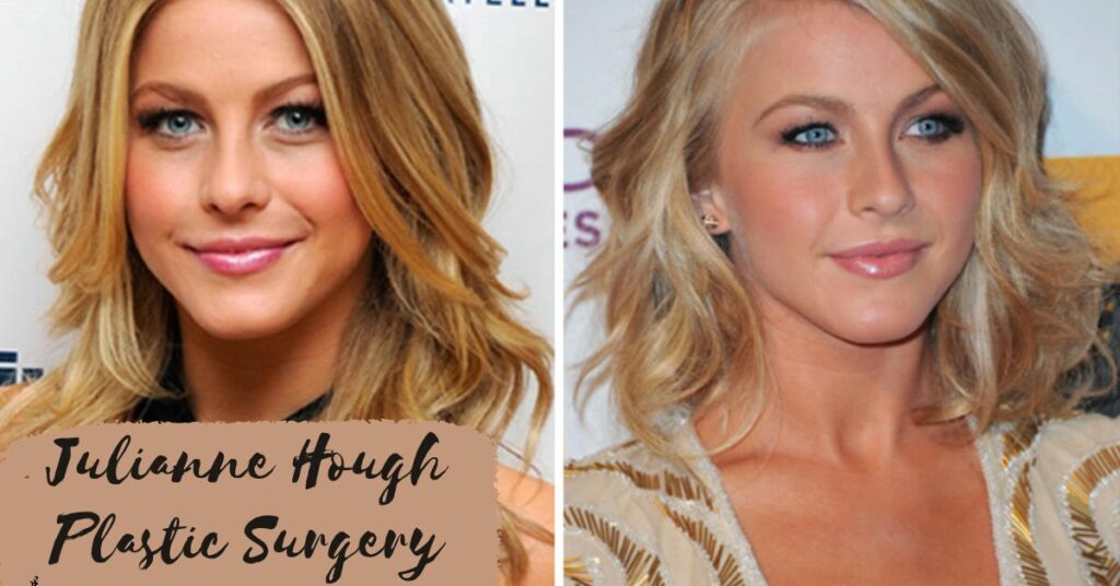 Julianne Hough Plastic Surgery