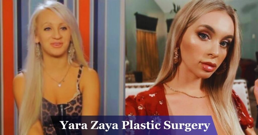 Yara Zaya Plastic Surgery